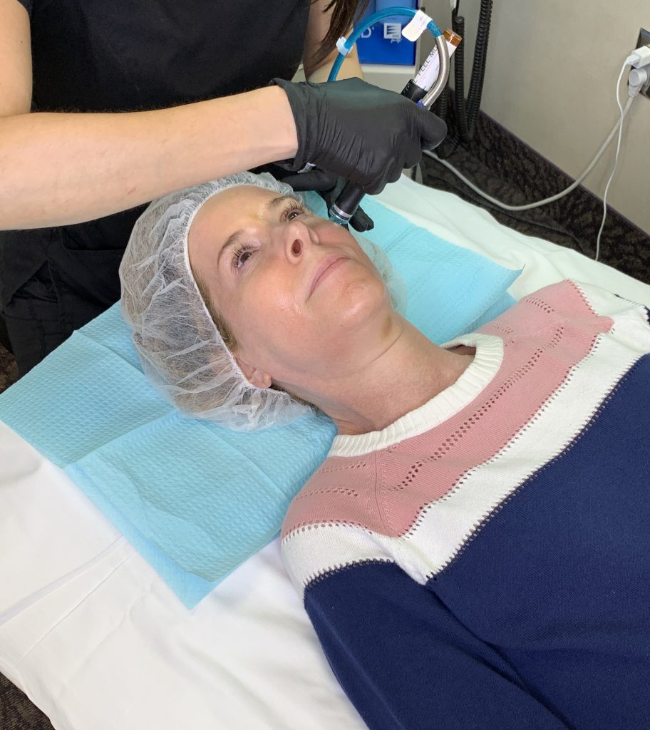 woman undergoing a HydraFacial