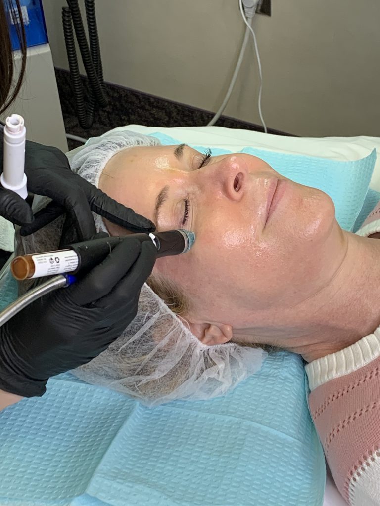 woman undergoing a HydraFacial