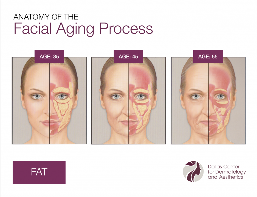 DCDA-Anatomy of the Facial Aging Process_Fat