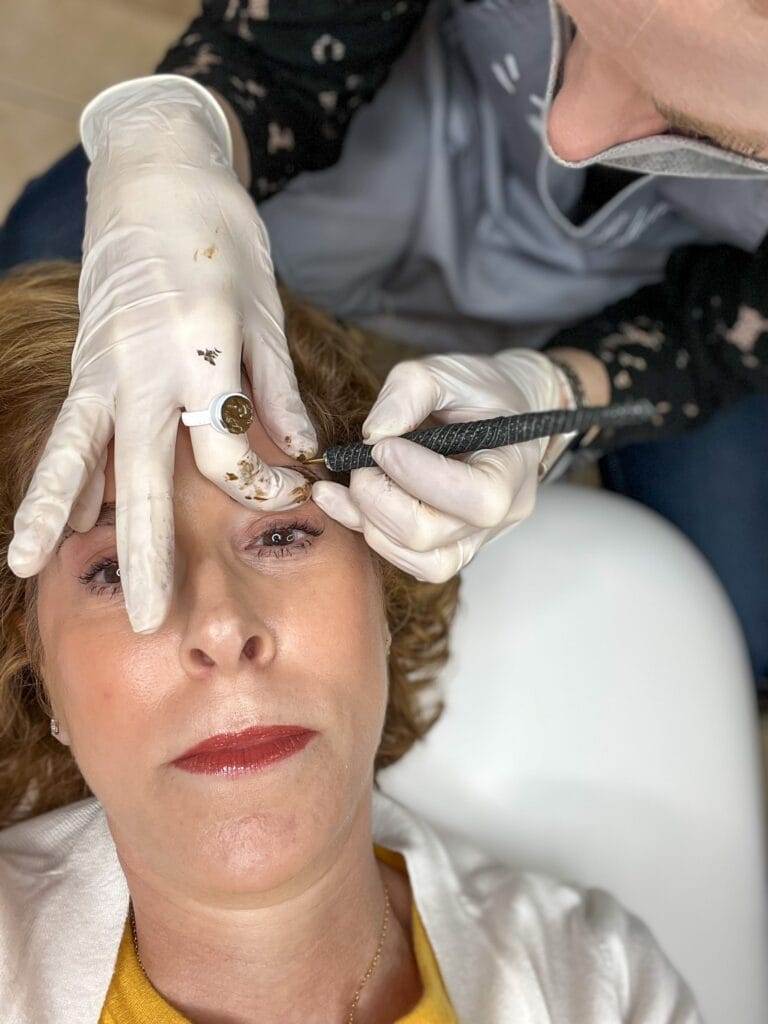 woman getting microbladed brows